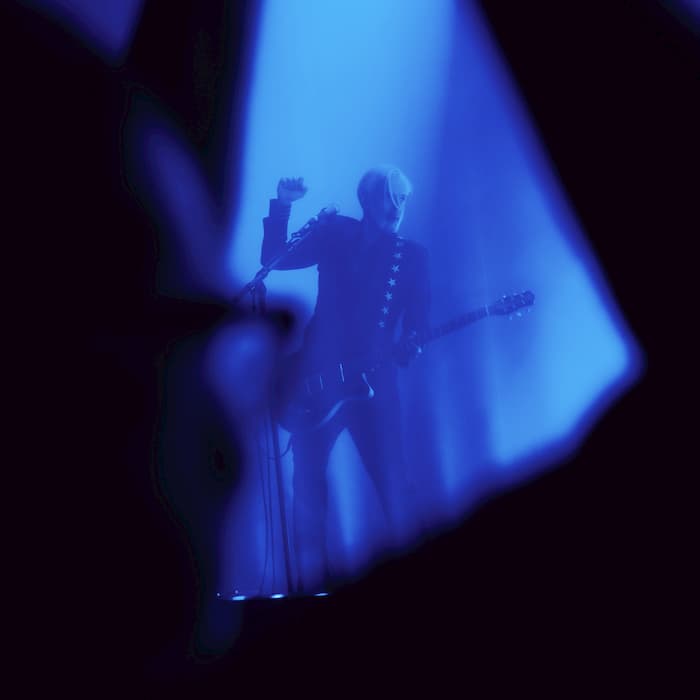 Triggerfinger